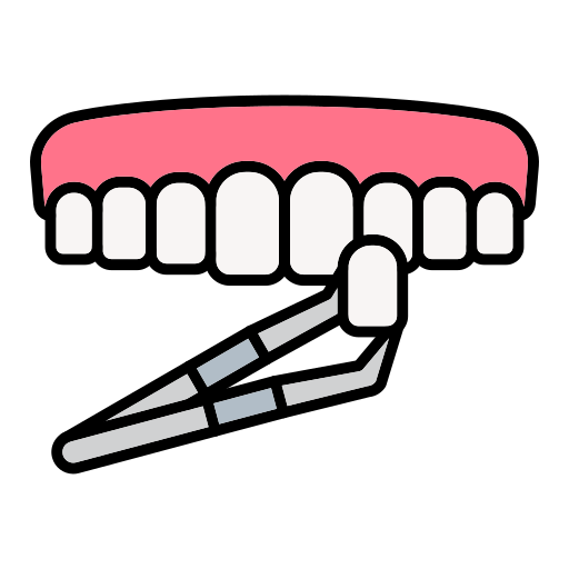 Dental veneers