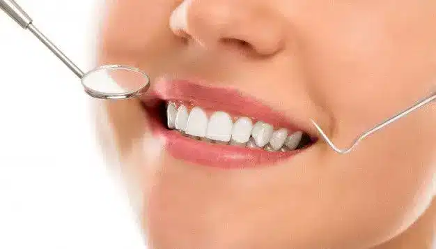 chez-dentiste-sourire-144627-884-626x357