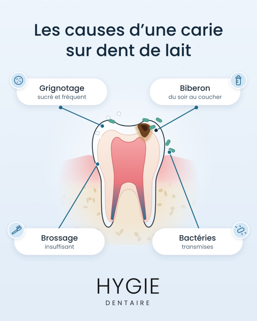 Dent de lait présentant des taches brunes évoquant une carie, illustrée entre une tasse de café, une brosse à dents et un fauteuil de dentiste.