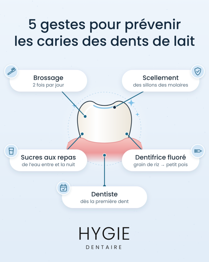 5 gestes essentiels pour prévenir les caries des dents de lait et préserver la santé bucco-dentaire des enfants.
